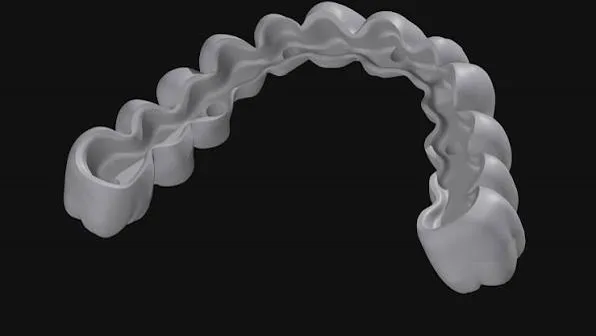 Full-arch milled framework render